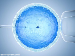 顕微授精 ICSI